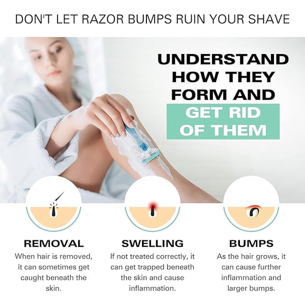 Bump Patrol For Her - Calm & Hydrating Aftershave for Women — product view